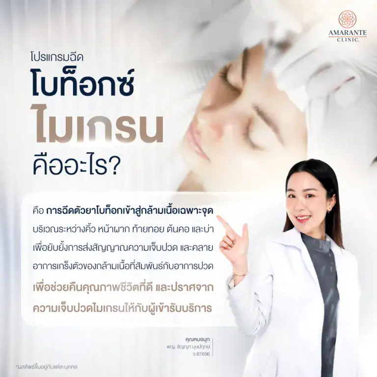 โบท็อกซ์ไมเกรน คืออะไร ?