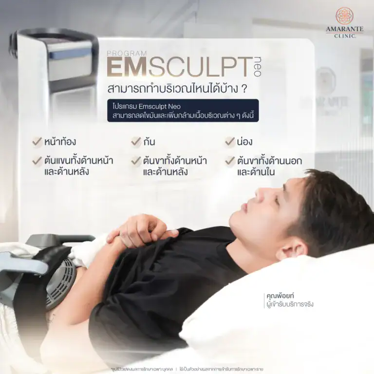 Emsculpt Neo สามารถทำบริเวณไหนได้บ้าง ?