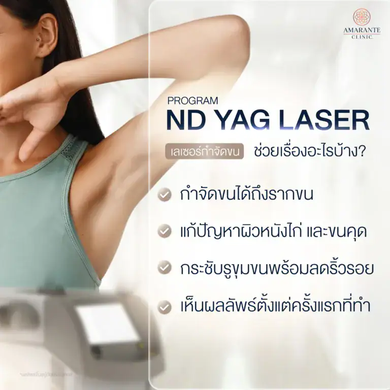 ND YAG Laser ช่วยเรื่องอะไร ?