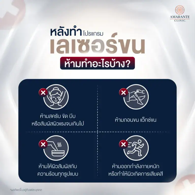 ข้อห้ามหลังทำเลเซอร์ขน