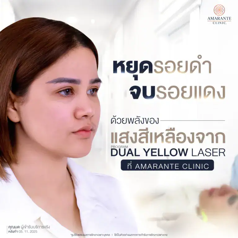 Dual Yellow Laser ที่ไหนดี