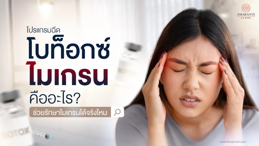 โบท็อกซ์ไมเกรน