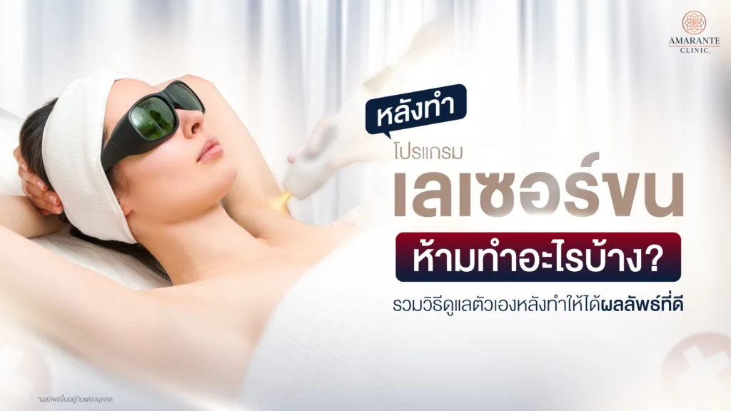 ข้อห้ามหลังทำเลเซอร์ขน