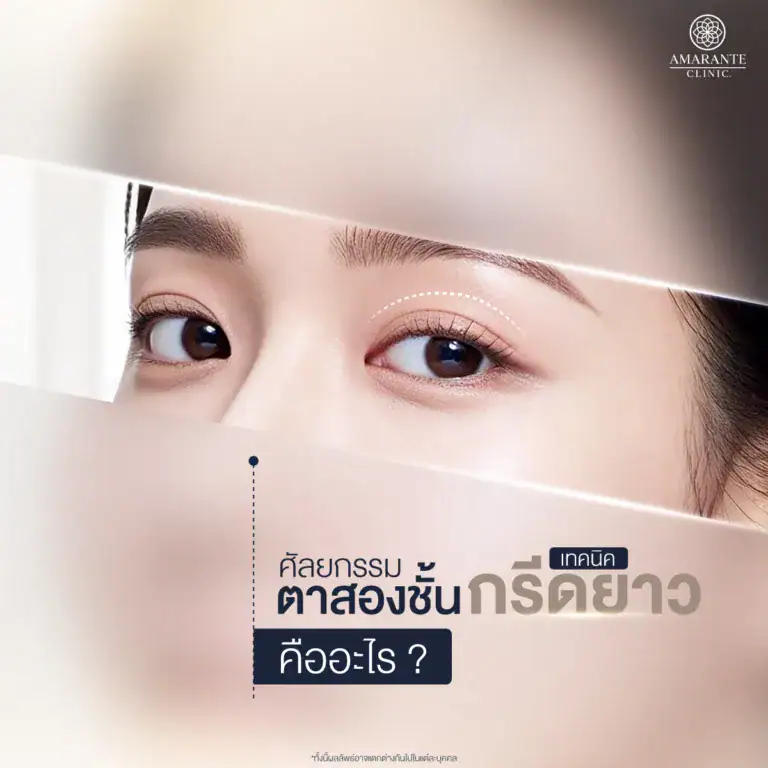 ตาสองชั้นกรีดยาว คืออะไร?