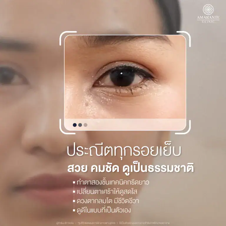 ทำตาสองชั้นกรีดยาว ที่ Amarante Clinic