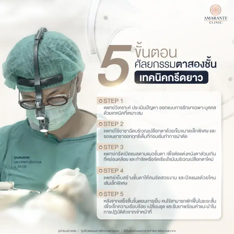 ขั้นตอนการผ่าตัดศัลยกรรมตาสองชั้นกรีดยาว