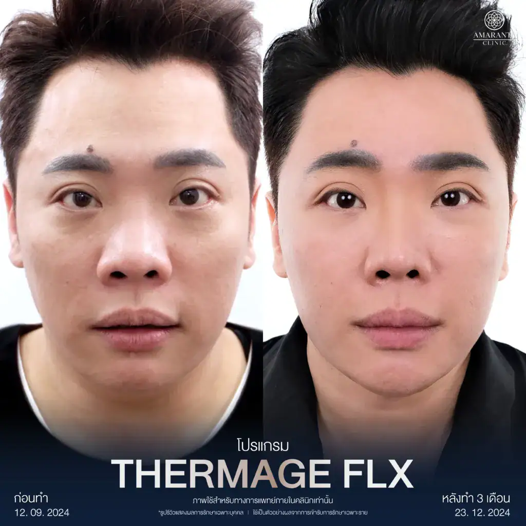 รีวิวผลลัพท์จากผู้เข้ารับบริการจริง