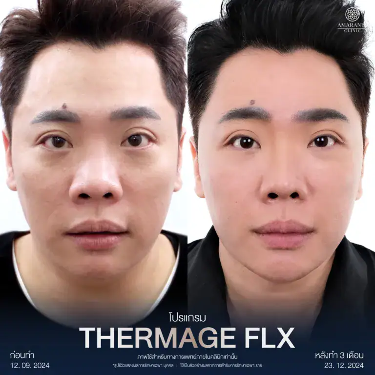 รีวิวผลลัพท์จากผู้เข้ารับบริการจริง