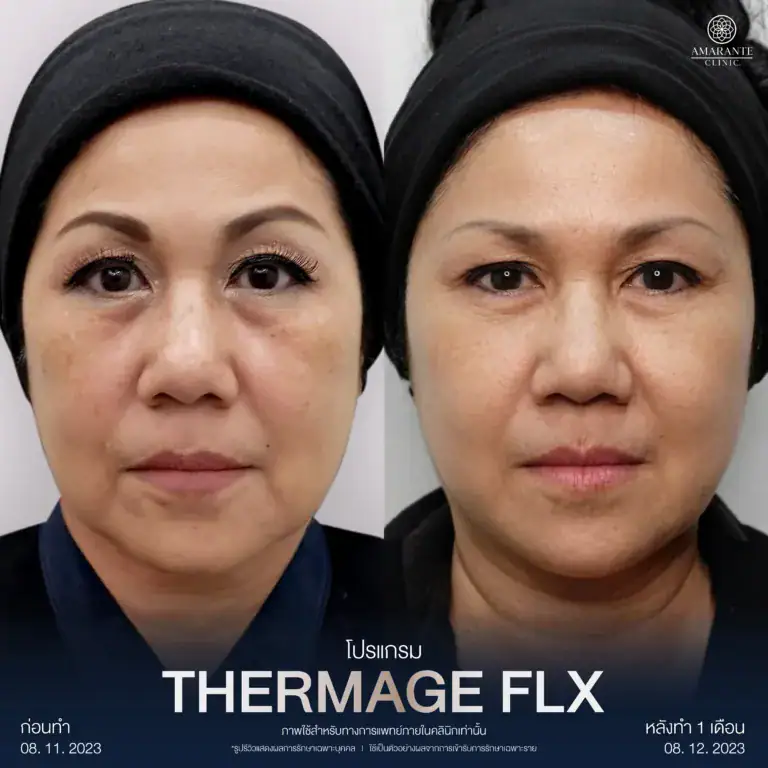รีวิวผลลัพท์จากผู้เข้ารับบริการจริง
