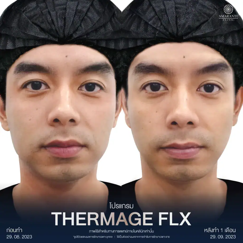 รีวิวผลลัพท์จากผู้เข้ารับบริการจริง