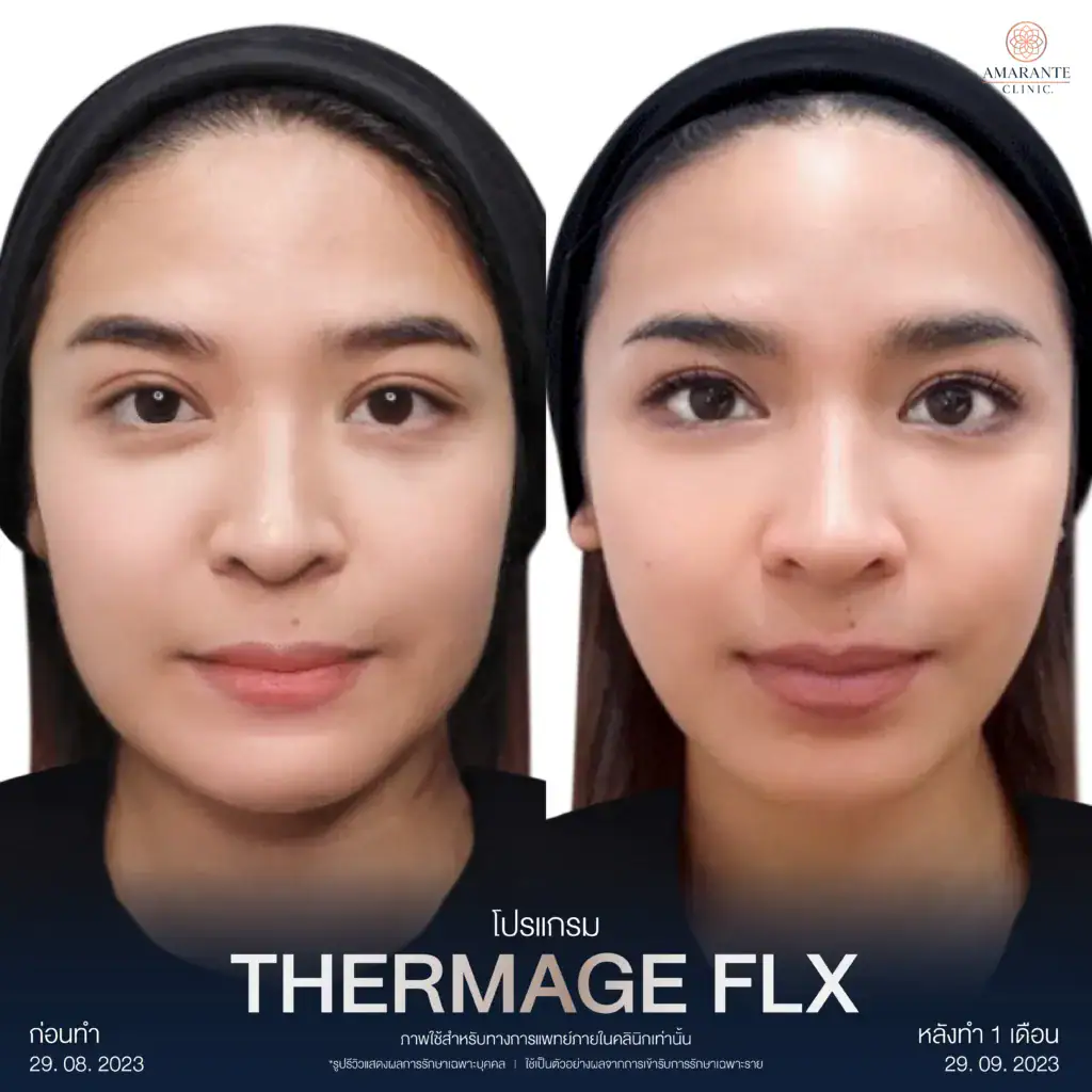 รีวิวผลลัพท์จากผู้เข้ารับบริการจริง
