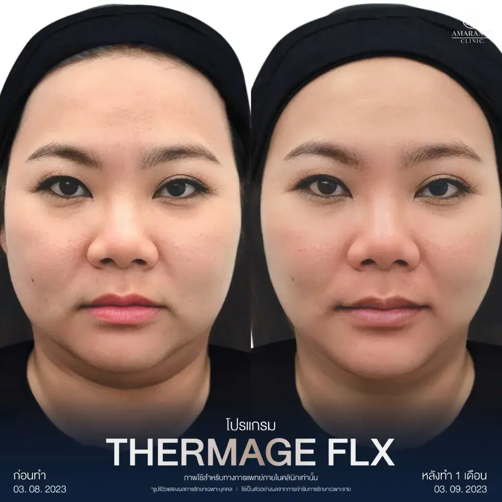 รีวิวผลลัพท์จากผู้เข้ารับบริการจริง