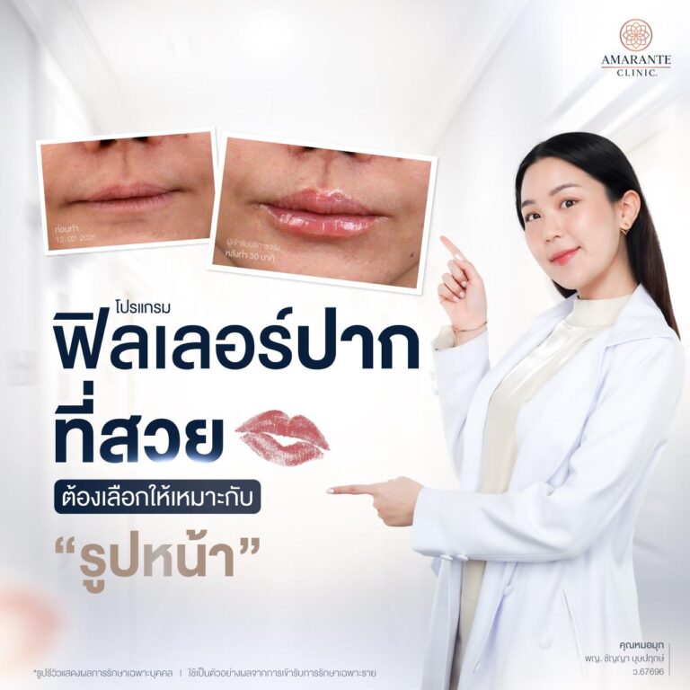 ฉีดฟิลเลอร์ปาก ทรงไหนดีให้เหมาะกับรูปหน้า