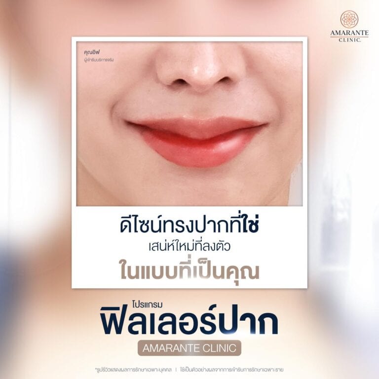 ฉีดฟิลเลอร์ปาก ที่ Amarante Clinic