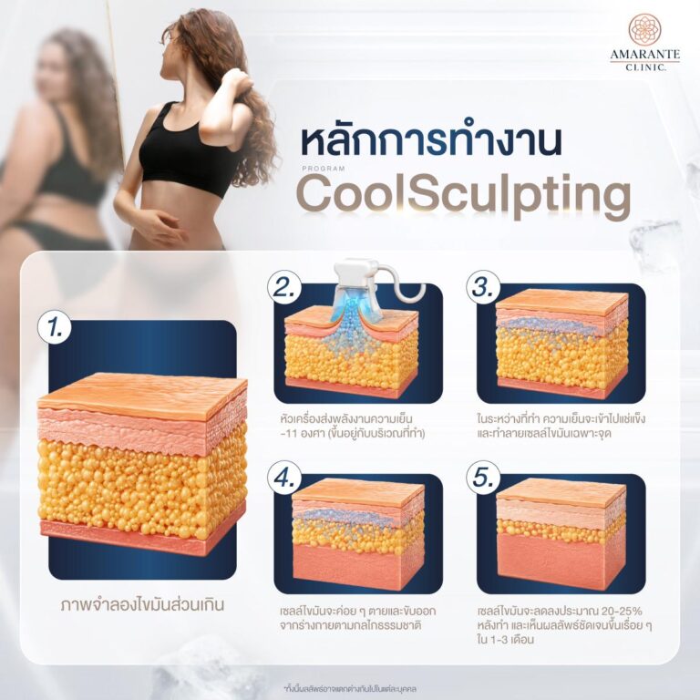 หลักการสลายไขมันด้วยความเย็น