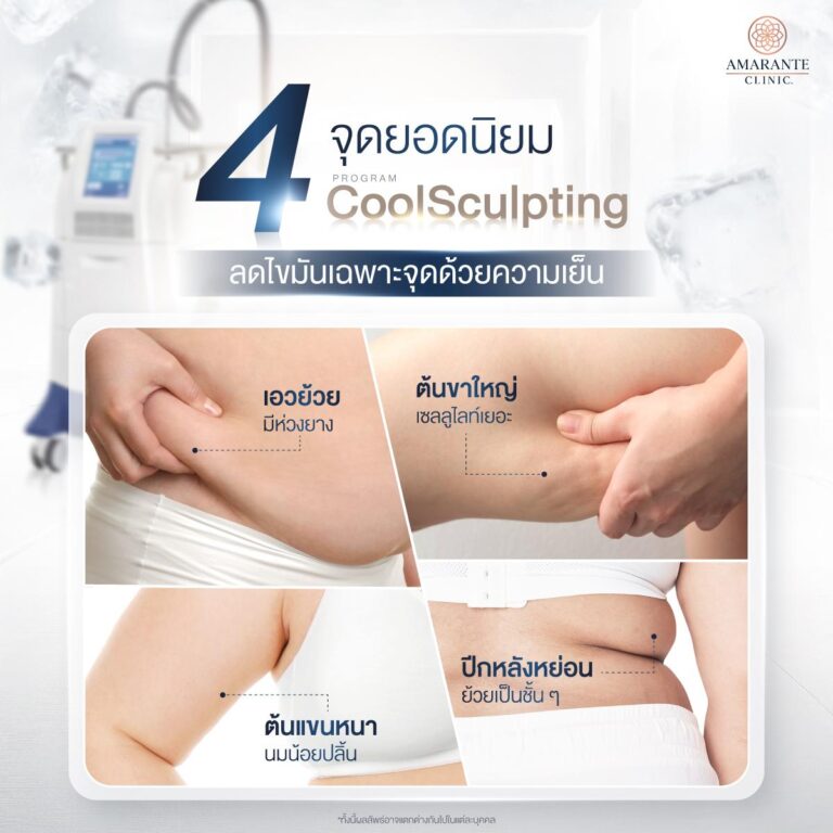จุดที่สลายไขมันด้วยความเย็น ลดสัดส่วนได้