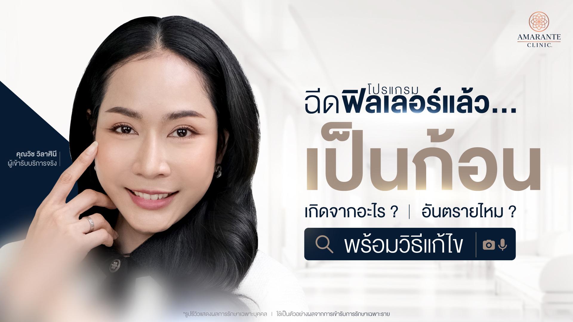 ฟิลเลอร์เป็นก้อน