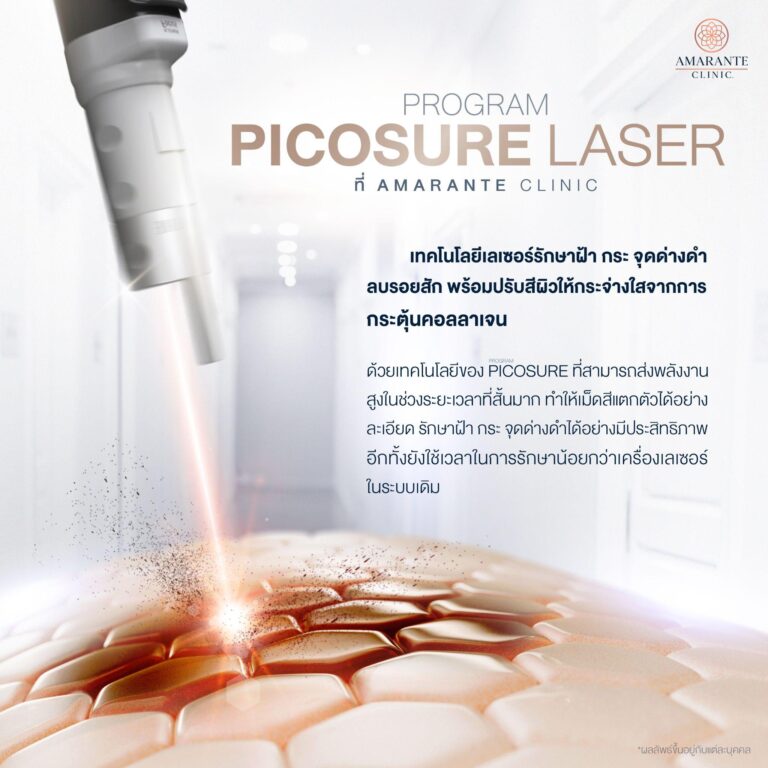 รักษาฝ้า กระลึก และจุดด่างดำ ด้วย Picosure Laser