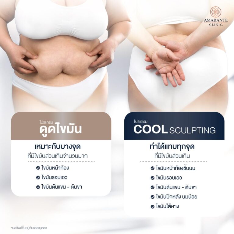 CoolSculpting สลายไขมันจุดไหนบ้าง