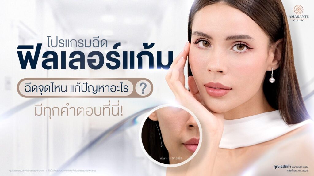 ฟิลเลอร์แก้ม