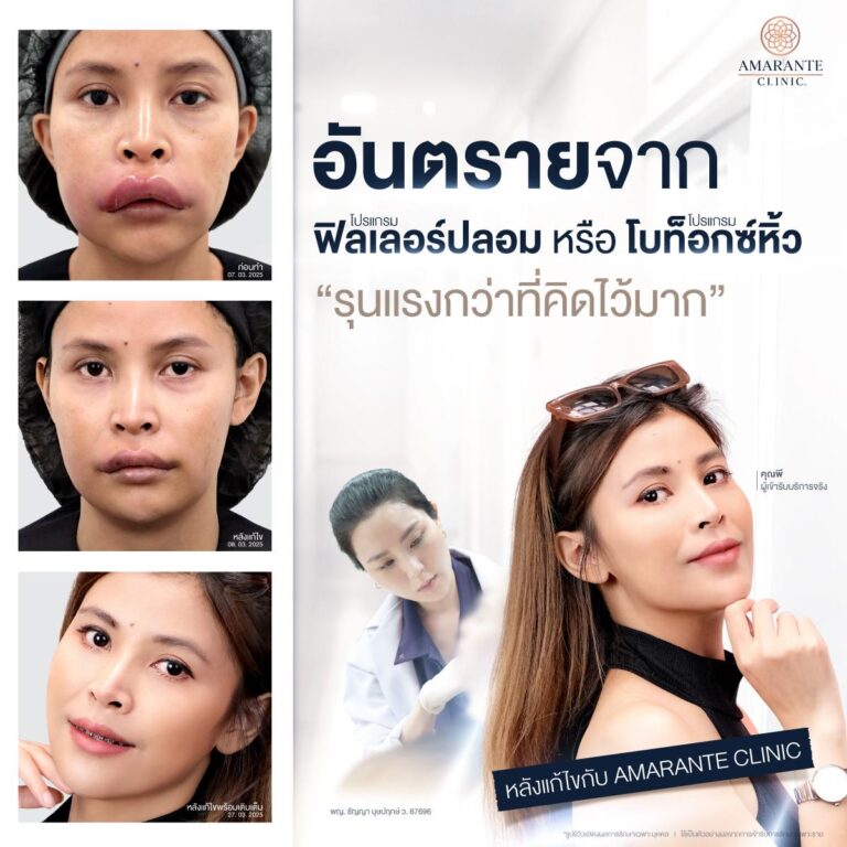 ขูดฟิลเลอร์แก้ไขปัญหาฉีดยาปลอม