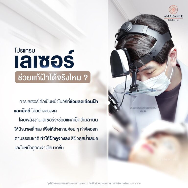 ลเซอร์ช่วยแก้ฝ้าได้จริงไหม