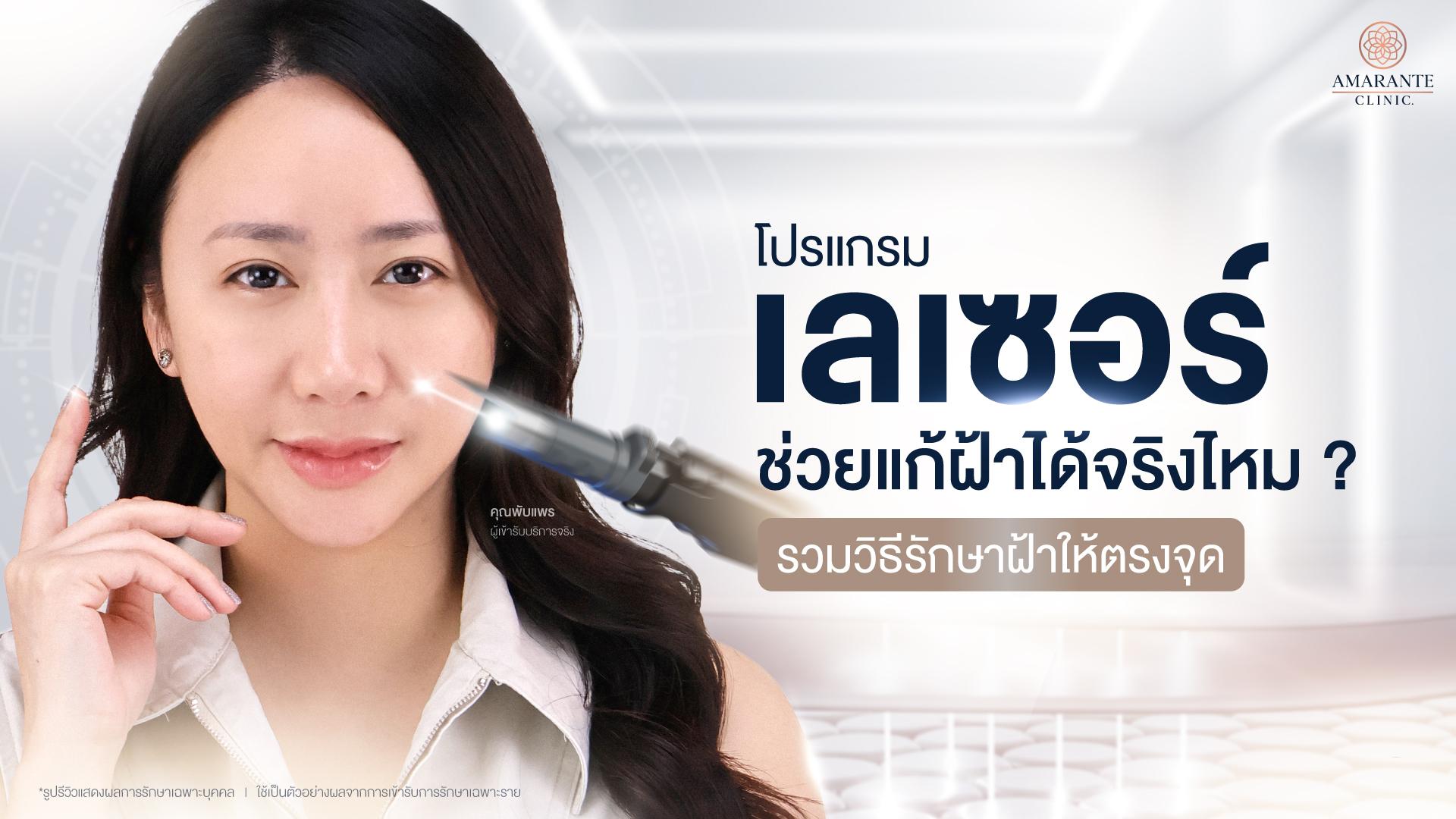 เลเซอร์รักษาฝ้าได้จริงไหม