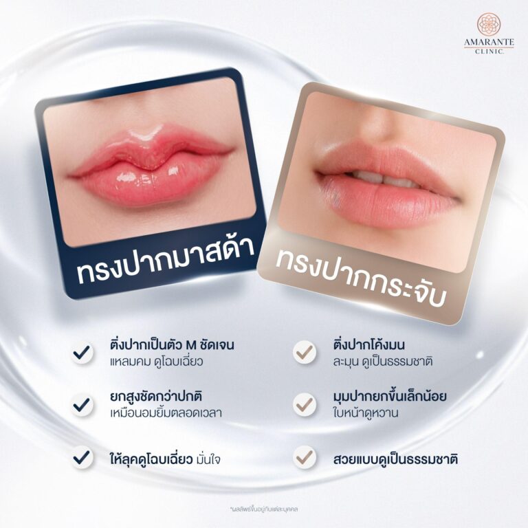 ความแตกต่างระหว่างปากกระจับกับปากมาสด้า
