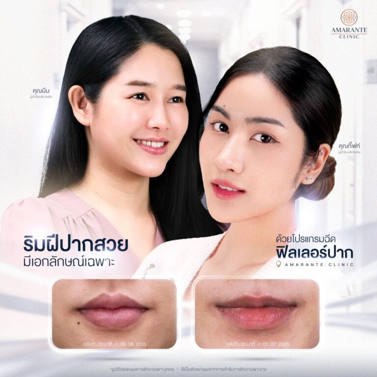 ฉีดฟิลเลอร์ปาก ที่ Amarante Clinic