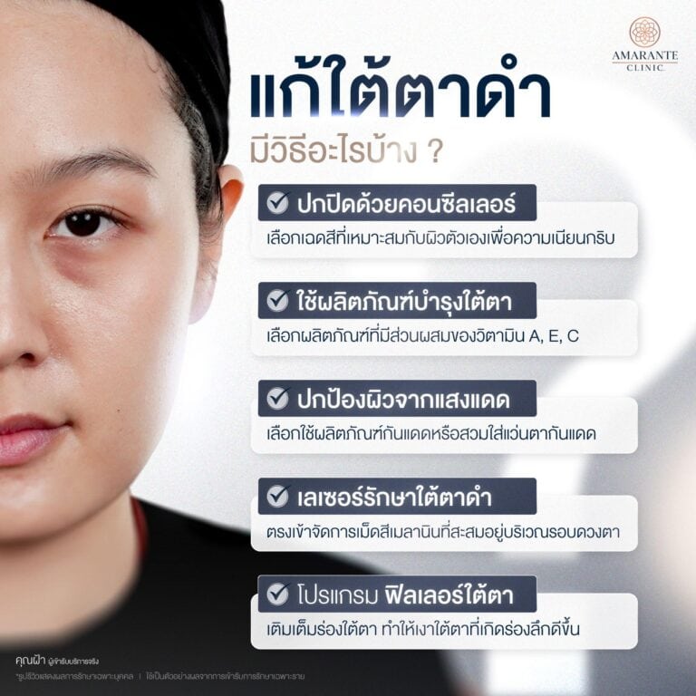 วิธีแก้ใต้ตาดำคล้ำ