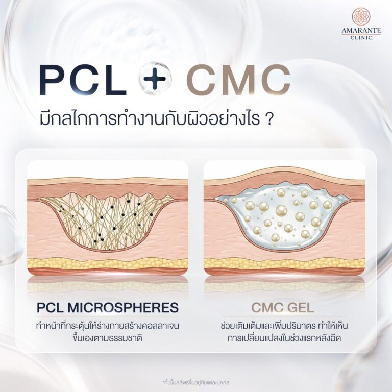 Structural Design with PCL + CMC