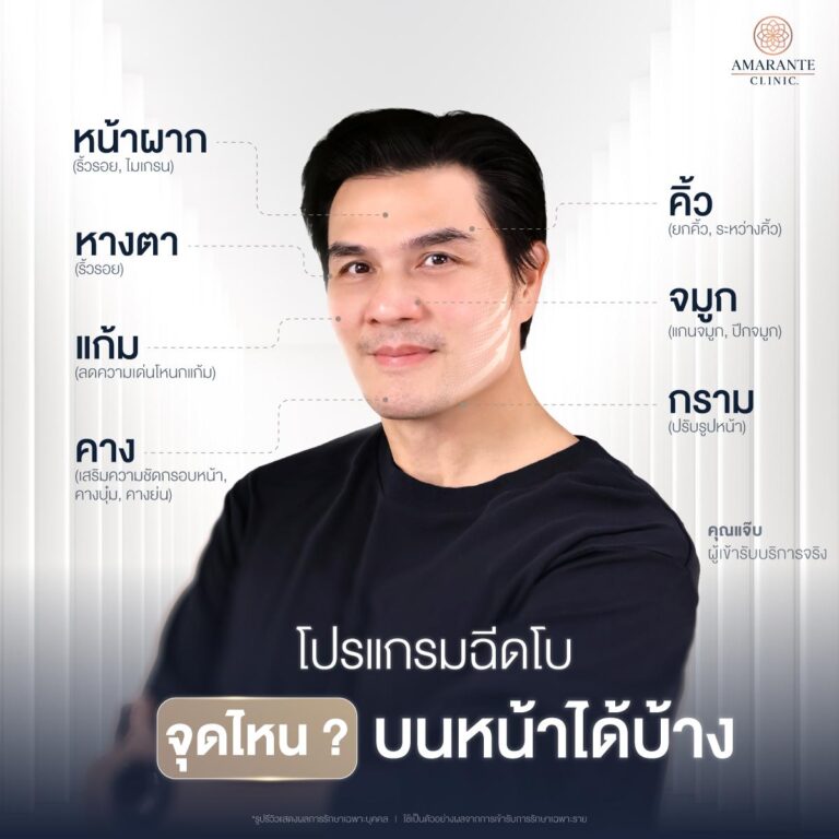 ฉีดโบท็อกจุดไหนบนหน้าได้บ้าง