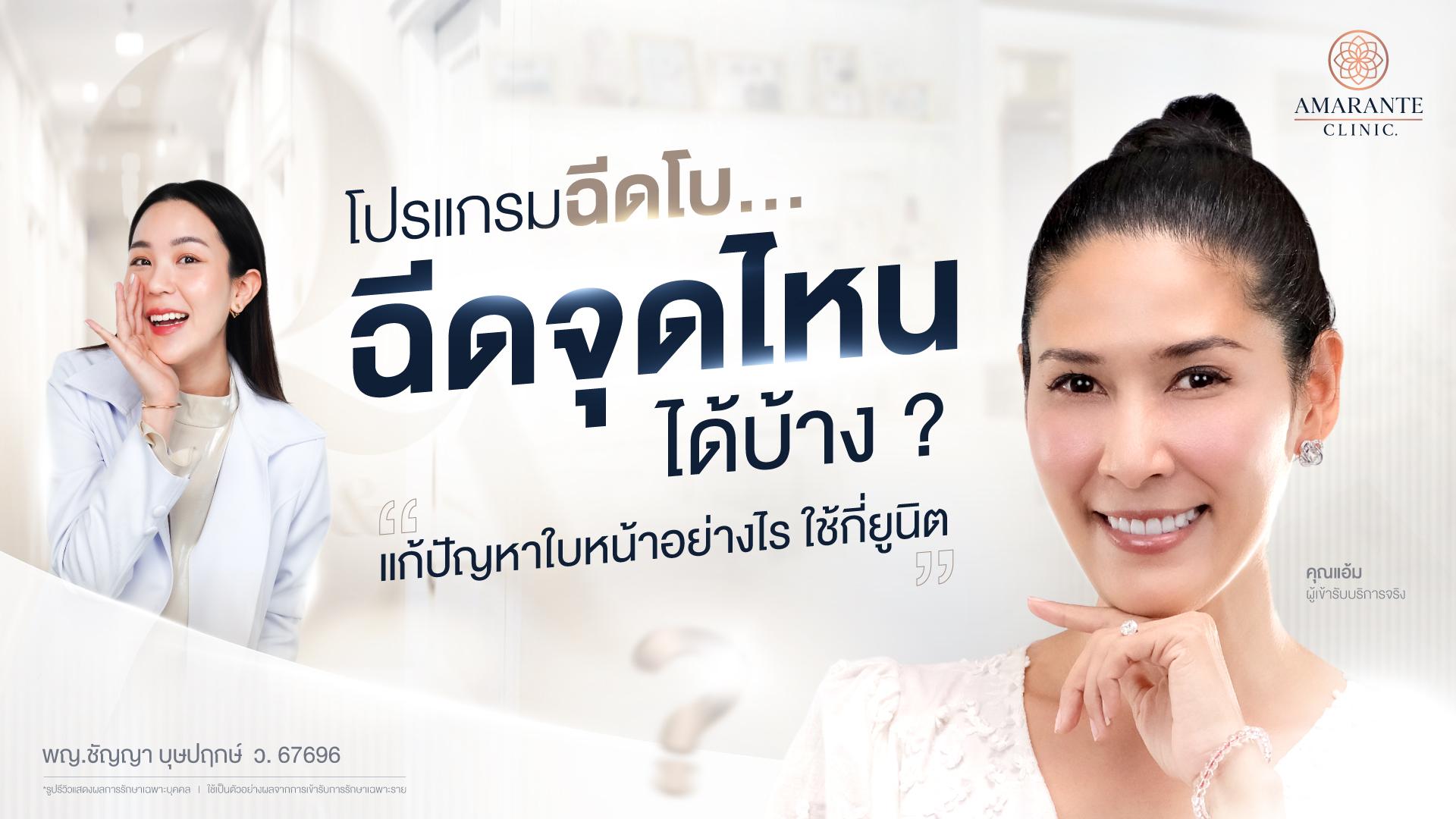 ฉีดโบท็อกจุดไหนได้บ้าง