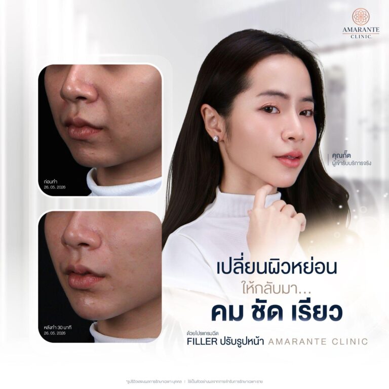 ฉีดฟิลเลอร์คางที่ Amarante Clinic
