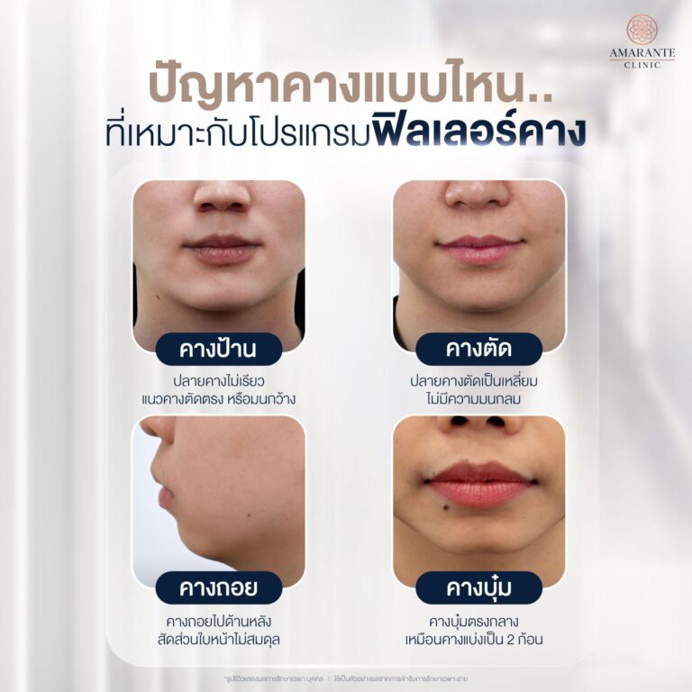 ลักษณะปัญหาคาง