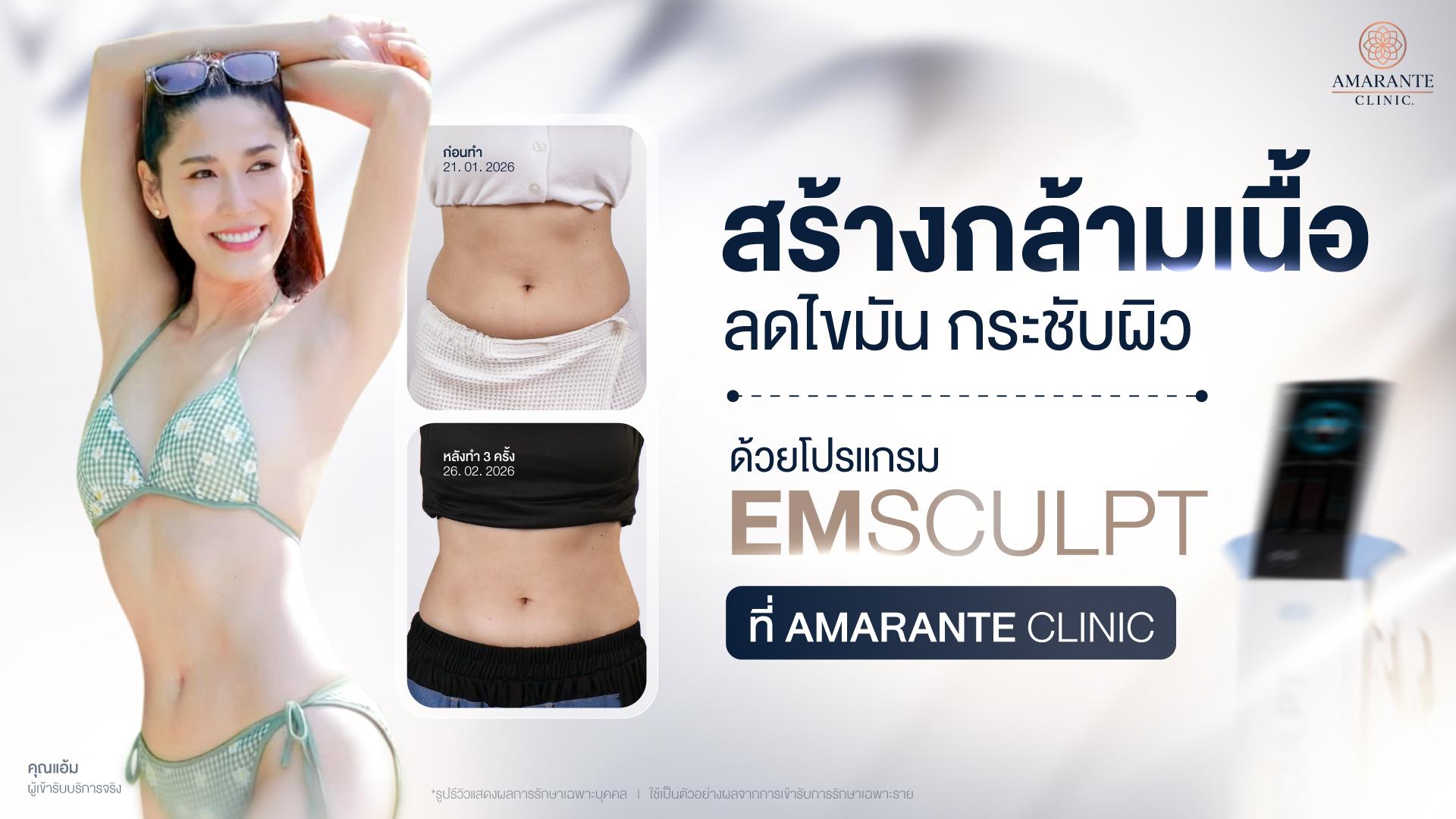 Emsculpt