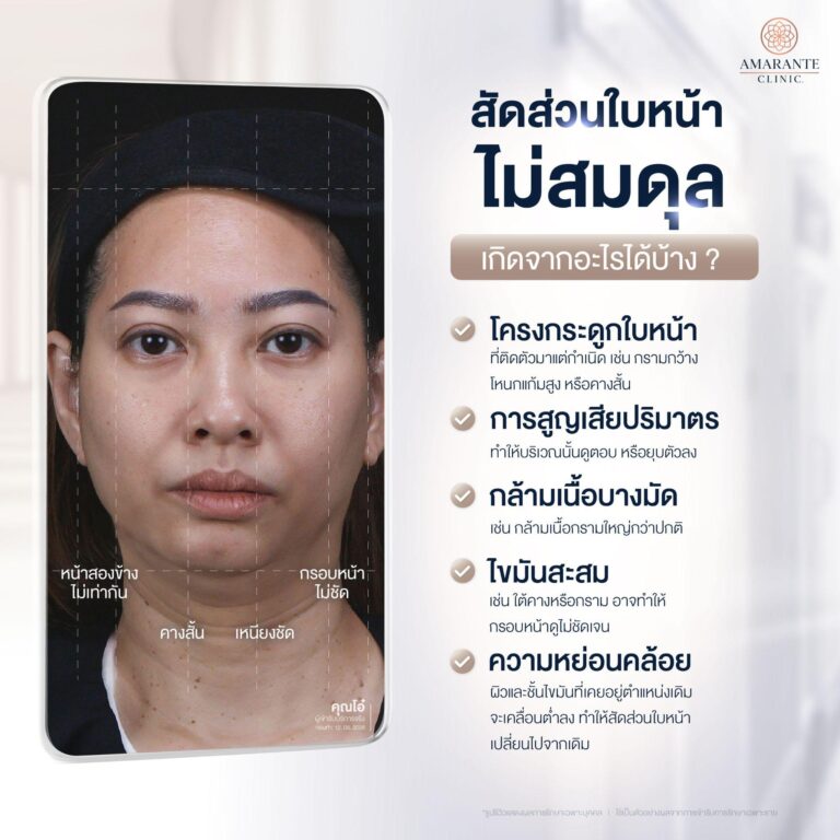 สัดส่วนใบหน้าไม่สมดุล เกิดจากอะไรได้บ้าง