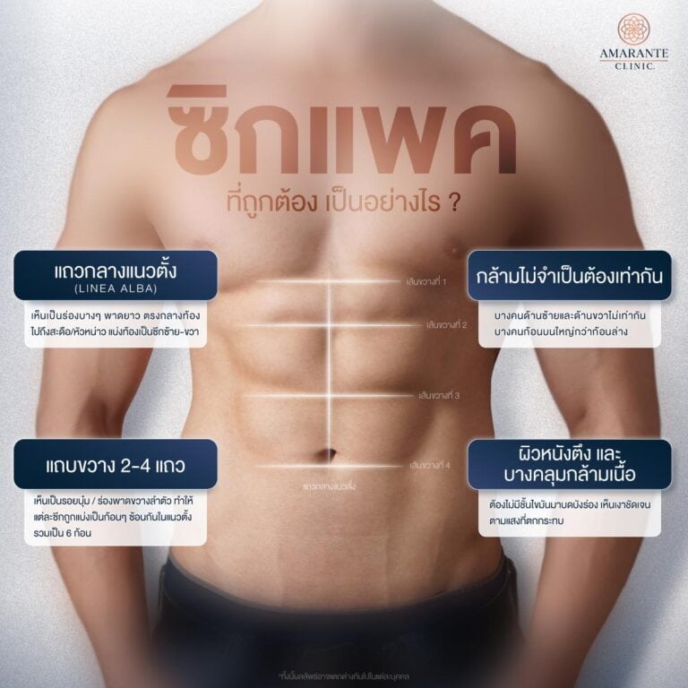 ลักษณะของซิกแพค