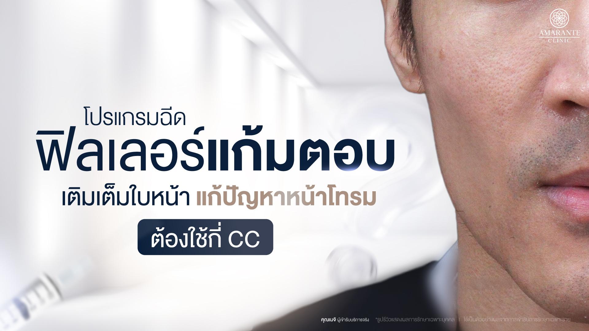 ฉีดฟิลเลอร์แก้มตอบ เติมเต็มแก้หน้าโทรม