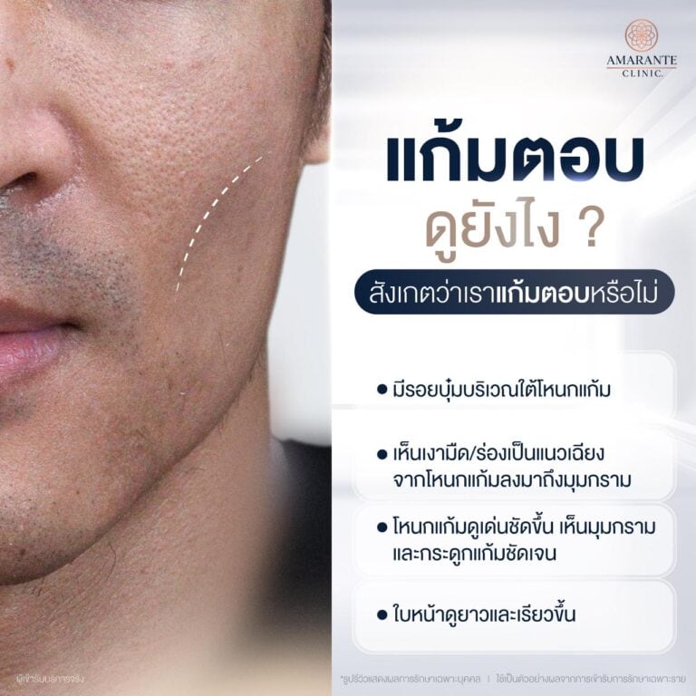 แก้มตอบ คืออะไร?