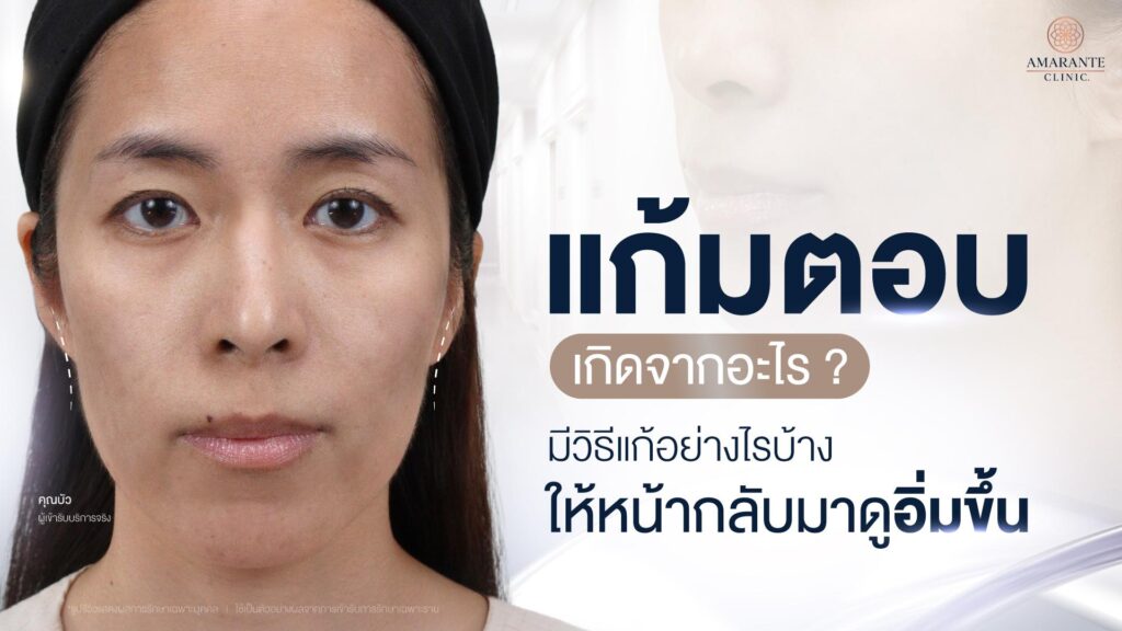 วิธีแก้แก้มตอบ