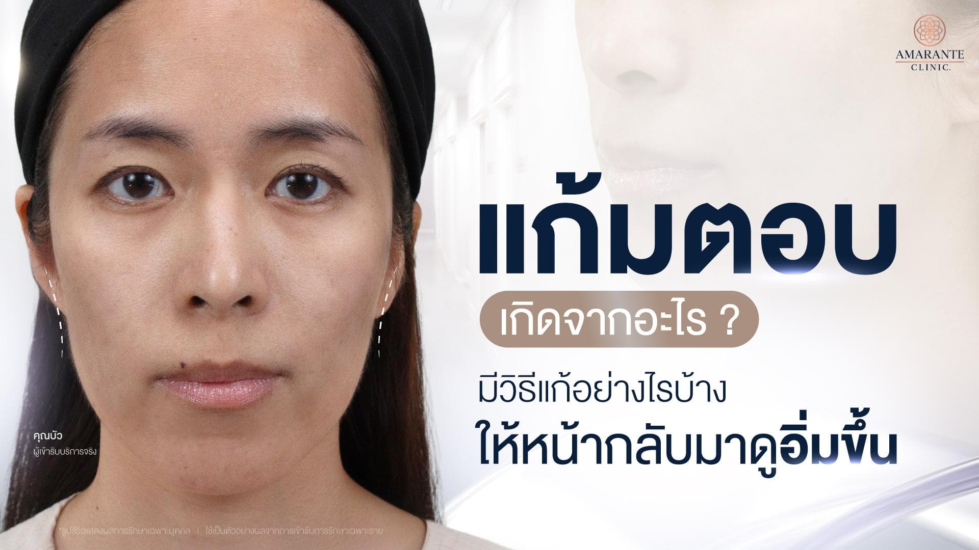 วิธีแก้แก้มตอบ