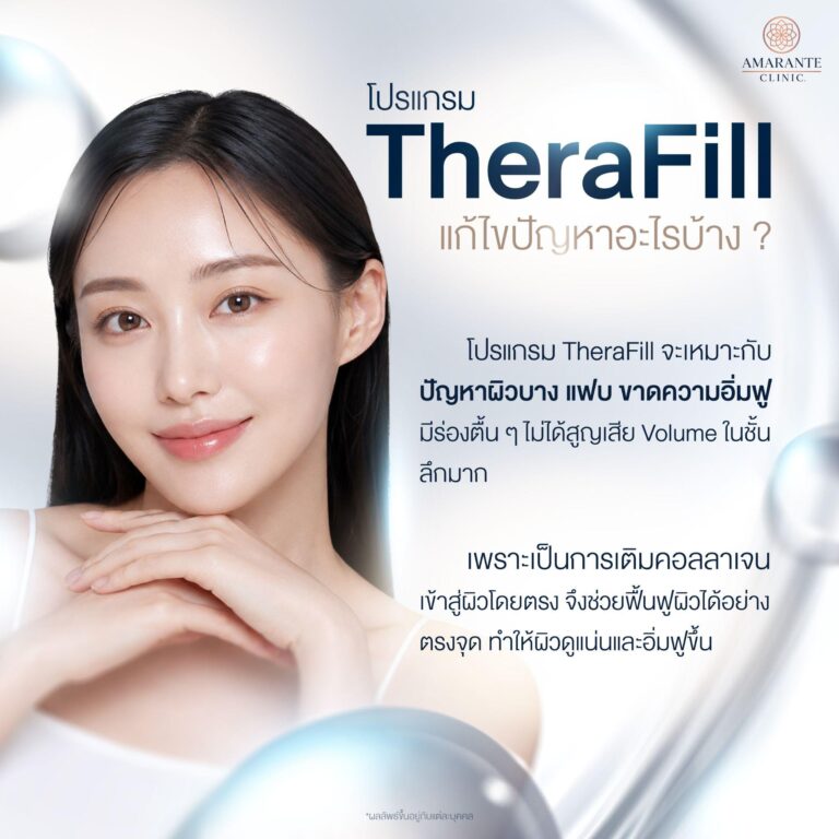 ฉีด TheraFill แก้หลุมสิว
