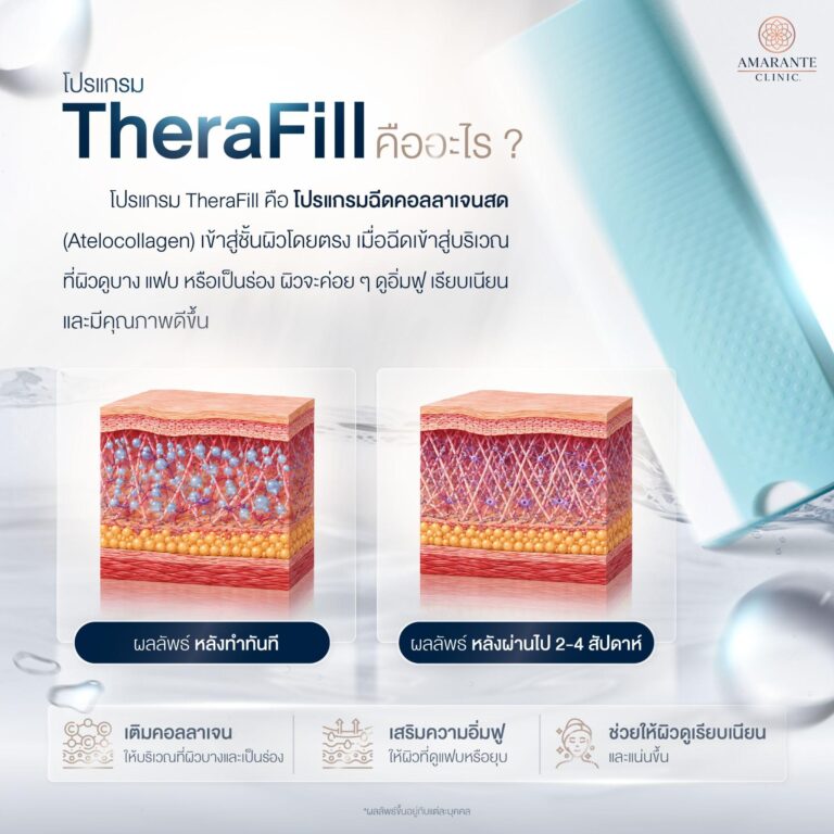TheraFill คืออะไร