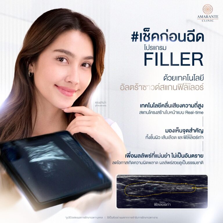 อัลตร้าซาวด์สแกนฟิลเลอร์ คืออะไร ?