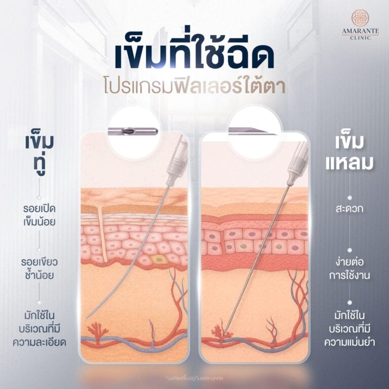เข็มที่ใช้ฉีดฟิลเลอร์ใต้ตา