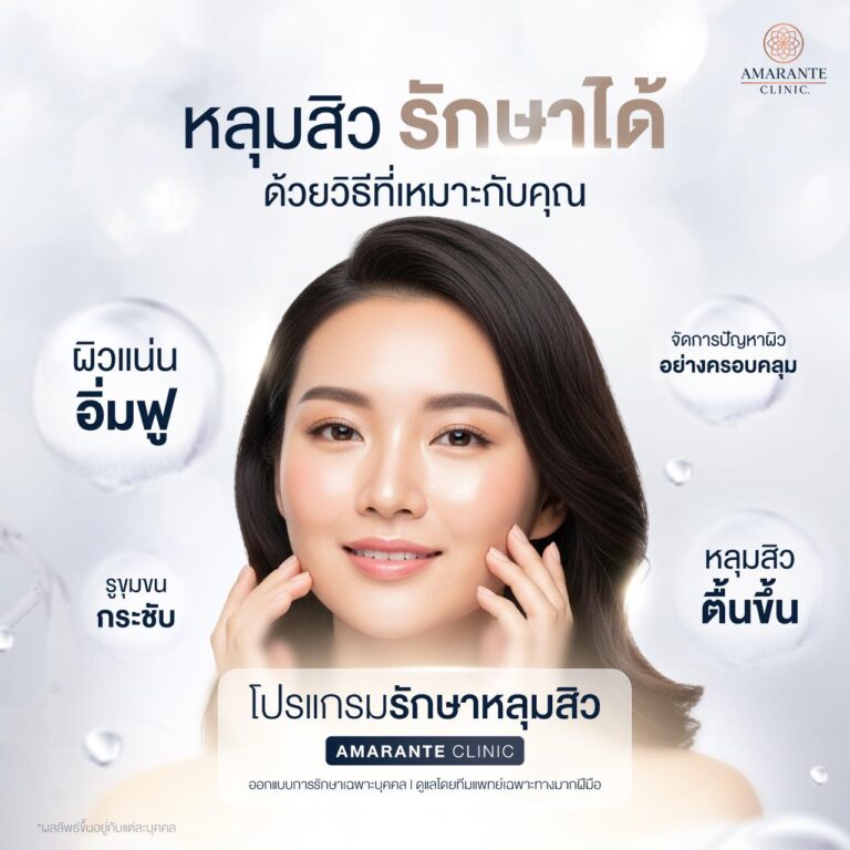 ฉีด Vitaran รักษาหลุมสิวที่ Amarante Clinic