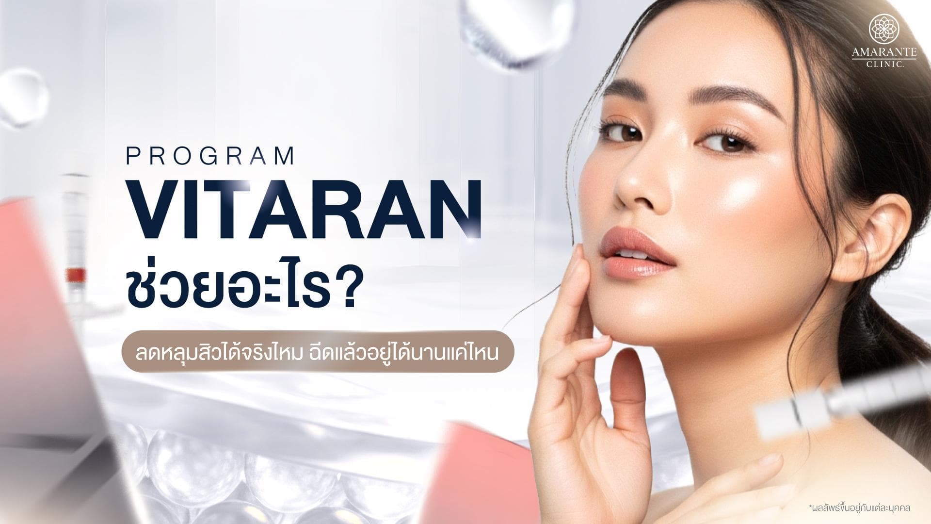 โปรแกรม Vitaran ช่วยอะไร ลดหลุมสิวได้จริงไหม