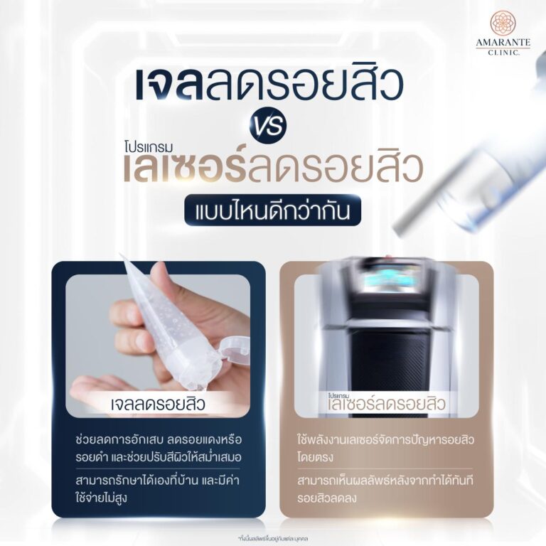กลไกการลดรอยสิว ระหว่างทาเจล กับ เลเซอร์