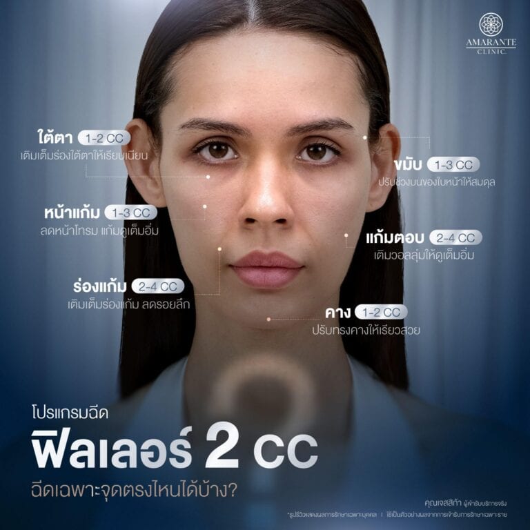 ฉีดฟิลเลอร์ 2 CC ฉีดเฉพาะจุดตรงไหนได้บ้าง?